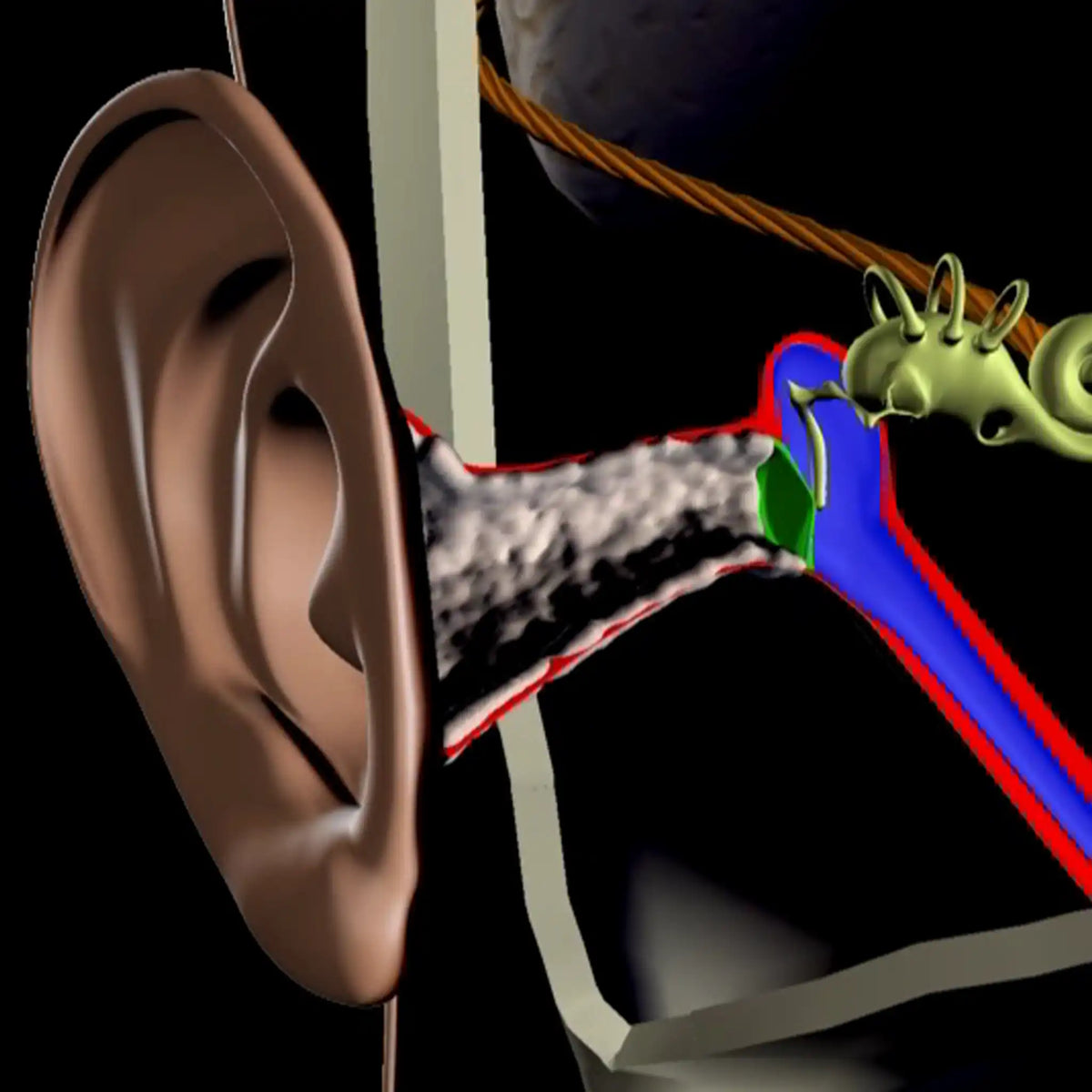 Hearing Conservation Streaming Access